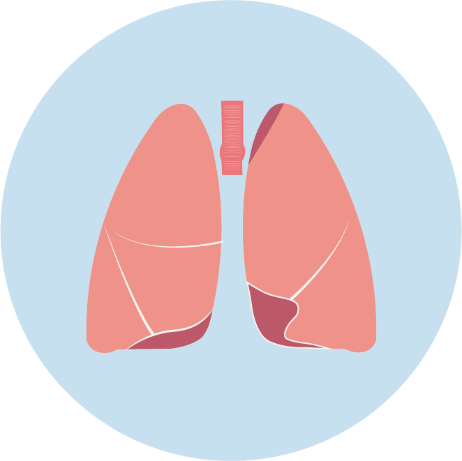 <b>【k8com官网基因检测】非小细胞肺癌靶向治疗药物泰圣奇基因检测</b>